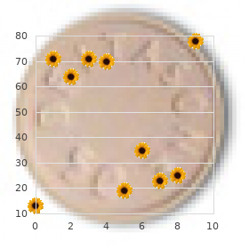 Chromosome 8, partial trisomy