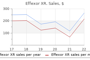 trusted 150 mg effexor xr