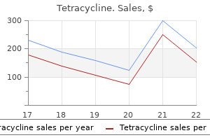 250 mg tetracycline for sale